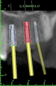 Cummings Blaise Implant View